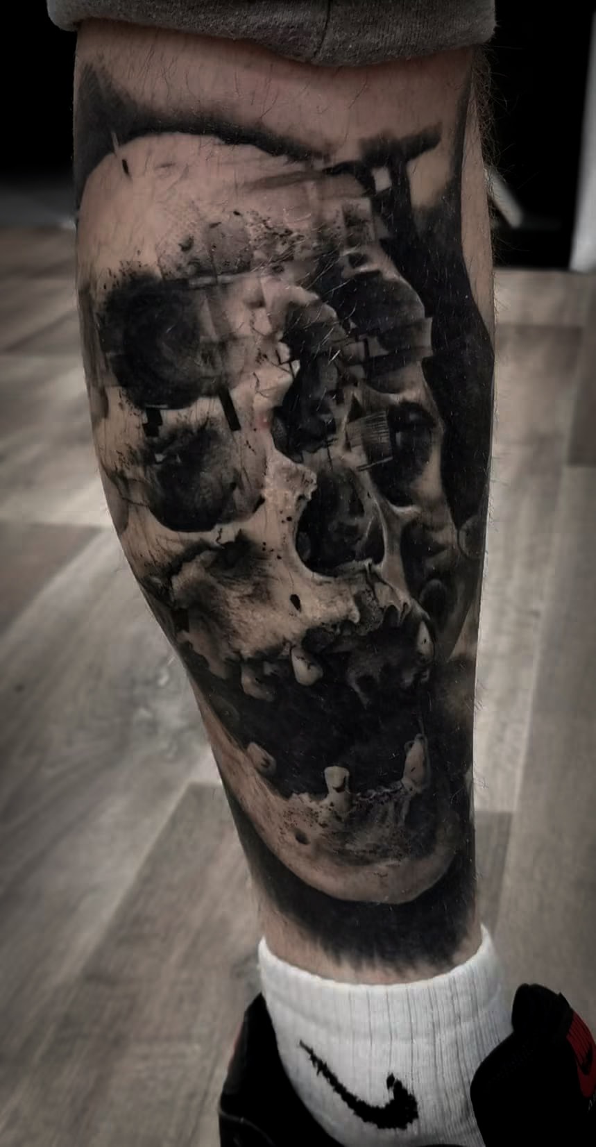 Fractured Skull