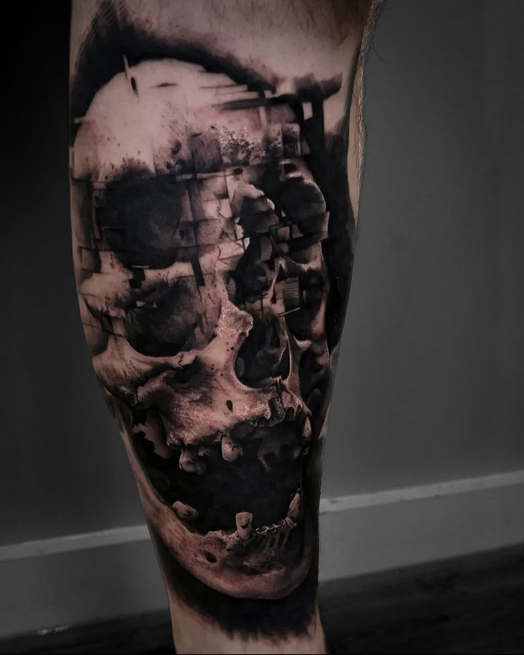 Fractured Skull